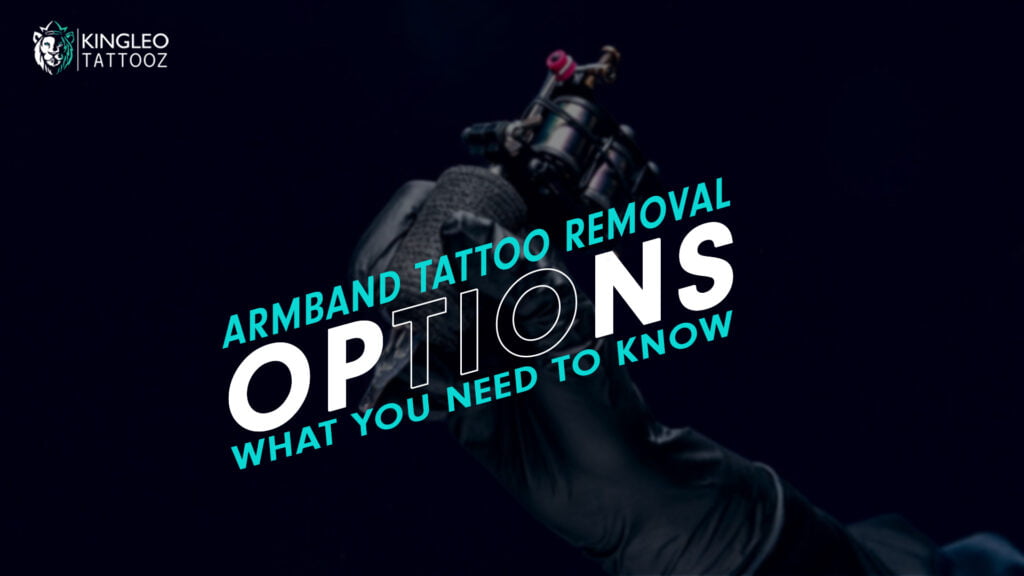 Armband Tattoo Removal Options: What you need to Know
